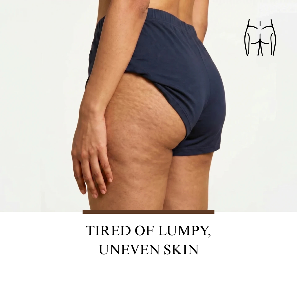 Tired of lumpy, uneven skin